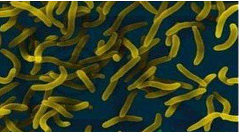 微生物菌劑好？好在哪里您知道嗎？